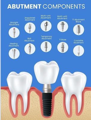 Impianto dentale personalizzato in 2D/3D Protesi per impianti regolari di collo stretti